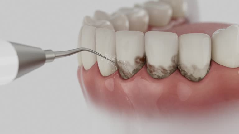 Trusted Dental Implants service in Vassar, MI - Dentist Open Now